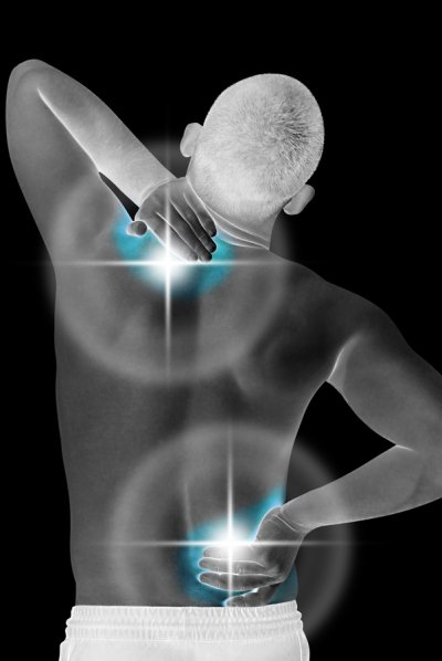 Diagram of a man having neck and back pain